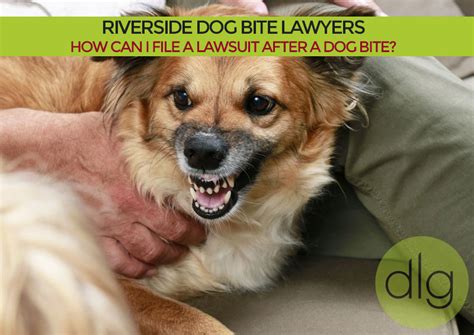 Dog bite lawyers near me. Things To Know About Dog bite lawyers near me. 